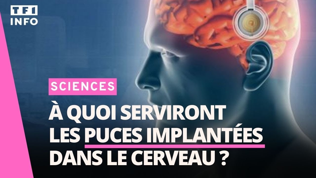 📚 Puces implantées dans le cerveau : quelles promesses ?