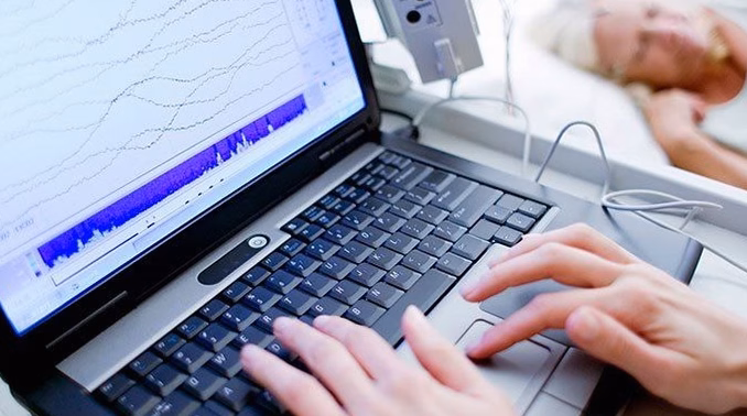 Outils d&rsquo;analyse web : alternatives à Google Analytics